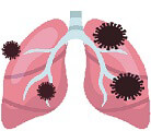 legionella come difendersi